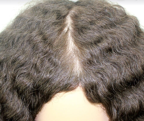 Cranial Prosthesis Wig